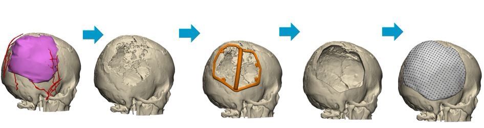 ריאליזם חדשני: תכנון מודל אנטומי תלת-ממדי המדמה מוח אנושי | מודל אנטומי