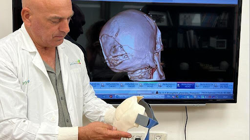 קסדה ראשונה מסוגה בישראל הודפסה בתלת מימד לפצוע ראש