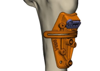 Synergy3DMed | BionicHive