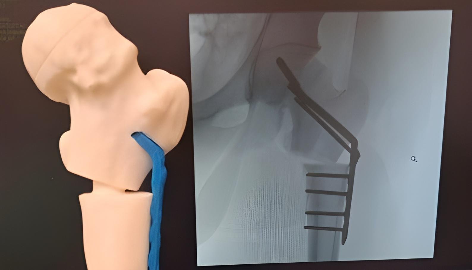 Tav Medical Case Study